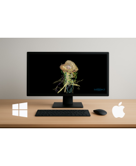 Cabeza y Cuello (Windows)