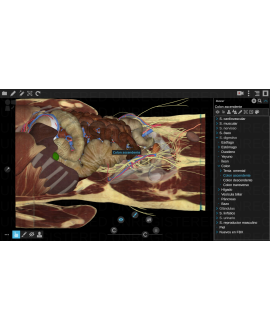 3dissect Abdomen  versión...